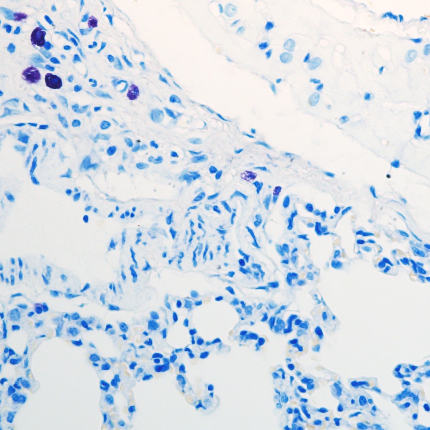 甲苯胺蓝染细胞核图片