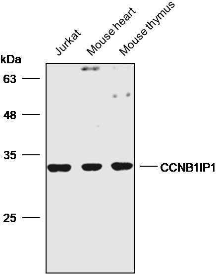 anti-ccnb1ip1 polyclonal antibody